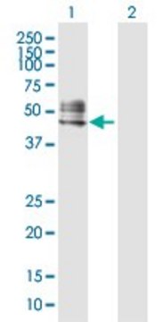 Anti-RTN4R antibody produced in rabbit purified immunoglobulin, buffered aqueous solution