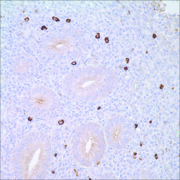 IgM Rabbit Polyclonal Antibody