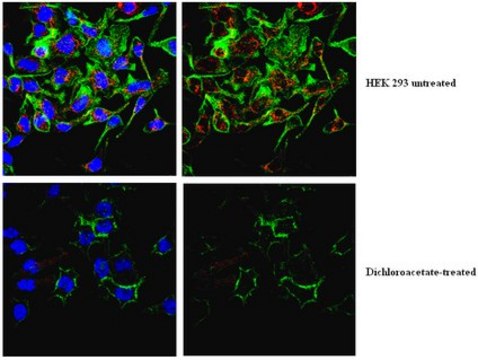 Anti-phospho PDHE1-A type I (Ser300) Antibody from rabbit, purified by affinity chromatography