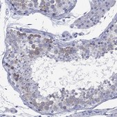 Anti-CCNA1 antibody produced in rabbit Prestige Antibodies&#174; Powered by Atlas Antibodies, affinity isolated antibody, buffered aqueous glycerol solution