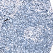 Anti-CHAT antibody produced in rabbit Prestige Antibodies&#174; Powered by Atlas Antibodies, affinity isolated antibody, buffered aqueous glycerol solution