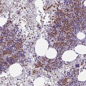 Anti-CDA antibody produced in rabbit Prestige Antibodies&#174; Powered by Atlas Antibodies, affinity isolated antibody, buffered aqueous glycerol solution