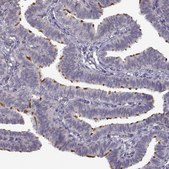 Anti-SPAG17 antibody produced in rabbit Prestige Antibodies&#174; Powered by Atlas Antibodies, affinity isolated antibody, buffered aqueous glycerol solution, ab2