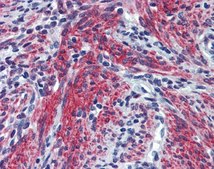 Anti-POSTN antibody produced in rabbit affinity isolated antibody