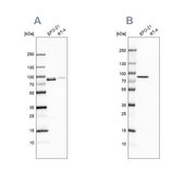 Anti-MSN antibody produced in rabbit Prestige Antibodies&#174; Powered by Atlas Antibodies, affinity isolated antibody, buffered aqueous glycerol solution