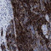 Anti-CEACAM5 antibody produced in rabbit Prestige Antibodies&#174; Powered by Atlas Antibodies, affinity isolated antibody, buffered aqueous glycerol solution