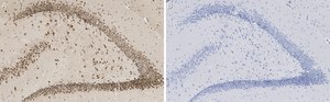 Anti-C9ORF72 (long form) Antibody, clone 1I9 ZooMAb&#174; Rabbit Monoclonal recombinant, expressed in HEK 293 cells