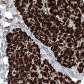 Monoclonal Anti-CPA1 antibody produced in mouse Prestige Antibodies&#174; Powered by Atlas Antibodies, clone CL6629, purified immunoglobulin, buffered aqueous glycerol solution