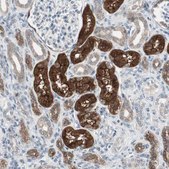 Anti-PDZK1 antibody produced in rabbit Prestige Antibodies&#174; Powered by Atlas Antibodies, affinity isolated antibody, buffered aqueous glycerol solution, Ab1
