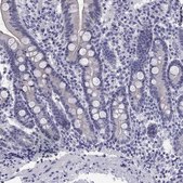 Anti-MUC15 antibody produced in rabbit Prestige Antibodies&#174; Powered by Atlas Antibodies, affinity isolated antibody, buffered aqueous glycerol solution