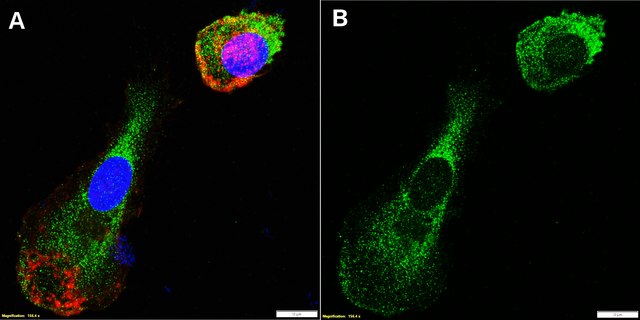 Anti-CD66b/CEACAM8 Antibody, clone 1L6 ZooMAb&#174; Rabbit Monoclonal recombinant, expressed in HEK 293 cells