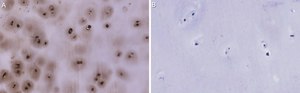 Anti-Aggrecan Antibody, clone 4B10 ZooMAb&#174; Rabbit Monoclonal recombinant, expressed in HEK 293 cells