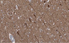 Anti-Neurofilament H Antibody, clone 5L10, ZooMAb&#174; Rabbit Monoclonal recombinant, expressed in HEK 293 cells