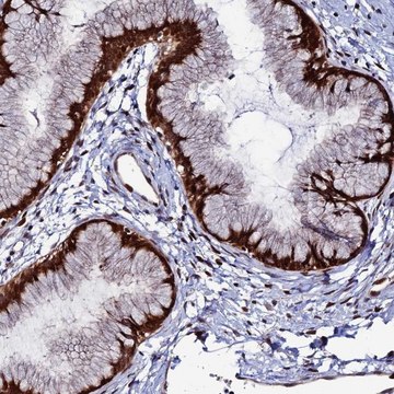 Anti-ZNF668 antibody produced in rabbit Prestige Antibodies&#174; Powered by Atlas Antibodies, affinity isolated antibody, buffered aqueous glycerol solution
