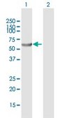 Anti-PHGDH antibody produced in mouse purified immunoglobulin, buffered aqueous solution