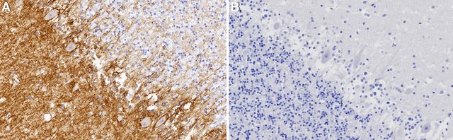 Anti-SLC1A3/EAAT1 Antibody, clone 2C3-K ZooMAb&#174; Rabbit Monoclonal recombinant, expressed in HEK 293 cells