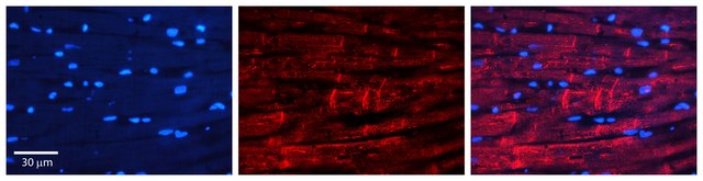 Anti-ADRB1 (C-terminal) antibody produced in rabbit affinity isolated antibody