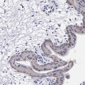Anti-CDH3 antibody produced in rabbit Prestige Antibodies&#174; Powered by Atlas Antibodies, affinity isolated antibody, buffered aqueous glycerol solution