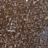 Anti-NFATC2 antibody produced in rabbit Prestige Antibodies&#174; Powered by Atlas Antibodies, affinity isolated antibody, buffered aqueous glycerol solution