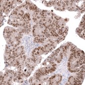 Anti-CDX2 antibody produced in mouse Prestige Antibodies&#174; Powered by Atlas Antibodies, clone CL12974, purified by using Protein A, buffered aqueous glycerol solution