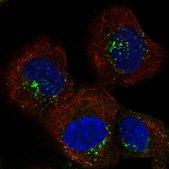 Anti-SNX2 antibody produced in rabbit Prestige Antibodies&#174; Powered by Atlas Antibodies, affinity isolated antibody, buffered aqueous glycerol solution
