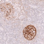 Monoclonal Anti-Cr2 Antibody Produced In Mouse Prestige Antibodies&#174; Powered by Atlas Antibodies, clone CL14552, affinity isolated antibody, buffered aqueous glycerol solution