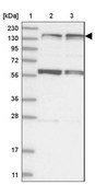 Anti-KIF4A antibody produced in rabbit Prestige Antibodies&#174; Powered by Atlas Antibodies, affinity isolated antibody, buffered aqueous glycerol solution