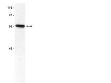 ATM/Chk2 Pathway Explorer Antibody MiniPack Upstate&#174;, from mouse, unconjugated