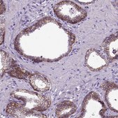Monoclonal Anti-CDH1 antibody produced in mouse Prestige Antibodies&#174; Powered by Atlas Antibodies, clone CL1172, purified immunoglobulin, buffered aqueous glycerol solution