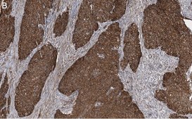 Anti-Integrin &#946;1 Antibody, clone 1A27 , ZooMAb&#174; Rabbit Monoclonal recombinant, expressed in HEK 293 cells