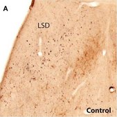 Monoclonal Anti-Tyrosine Hydroxylase antibody produced in mouse clone TH-16, ascites fluid