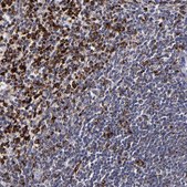 Anti-CTSS antibody produced in rabbit Prestige Antibodies&#174; Powered by Atlas Antibodies, affinity isolated antibody, buffered aqueous glycerol solution