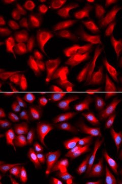 Anti- CD168/RHAMM antibody produced in rabbit