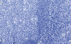 Anti-CD19 Antibody, clone 3E7 ZooMAb&#174; Rabbit Monoclonal recombinant, expressed in HEK 293 cells
