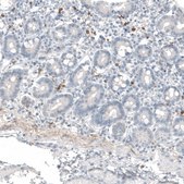 Monoclonal Anti-B3GAT1 antibody produced in mouse Prestige Antibodies&#174; Powered by Atlas Antibodies, clone CL9500, purified immunoglobulin, buffered aqueous glycerol solution