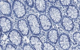 Anti-Rictor Antibody, clone 1K9 ZooMAb&#174; Rabbit Monoclonal recombinant, expressed in HEK 293 cells