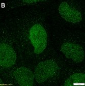 Anti-KEAP1 Antibody, clone 3B9 ZooMAb&#174; Rabbit Monoclonal recombinant, expressed in HEK 293 cells