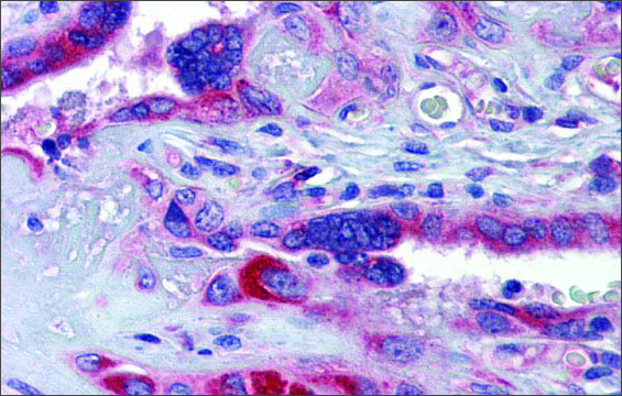 Anti-GTPBP10 (ab1) antibody produced in rabbit affinity isolated antibody