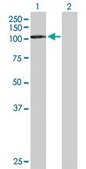 Anti-DDX20 antibody produced in mouse purified immunoglobulin, buffered aqueous solution