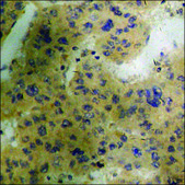 Anti-phospho-GR (pSer226) antibody produced in rabbit affinity isolated antibody