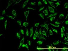 Monoclonal Anti-TOMM20 antibody produced in mouse clone 4F3, purified immunoglobulin, buffered aqueous solution