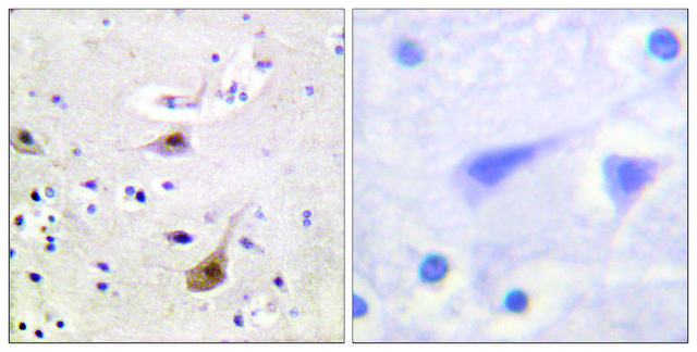 Anti-Androgen Receptor, N-Terminal antibody produced in rabbit affinity isolated antibody