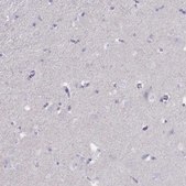 Anti-TBX19 antibody produced in rabbit Prestige Antibodies&#174; Powered by Atlas Antibodies, affinity isolated antibody