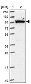Anti-MOCOS antibody produced in rabbit Prestige Antibodies&#174; Powered by Atlas Antibodies, affinity isolated antibody, buffered aqueous glycerol solution