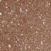 Anti-FXYD6 antibody produced in rabbit Prestige Antibodies&#174; Powered by Atlas Antibodies, affinity isolated antibody, buffered aqueous glycerol solution