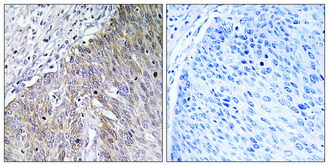 Anti-APOL2 antibody produced in rabbit affinity isolated antibody