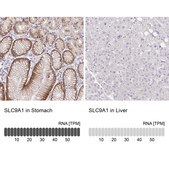 Anti-SLC9A1 antibody produced in rabbit Prestige Antibodies&#174; Powered by Atlas Antibodies, affinity isolated antibody, buffered aqueous glycerol solution
