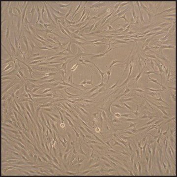 Human Fibroblast-Like Synoviocytes: HFLS, adult