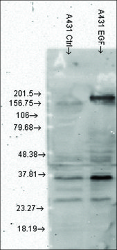 Monoclonal Anti-Phosphotyrosine antibody produced in mouse clone G104, 1&#160;mg/mL, purified immunoglobulin