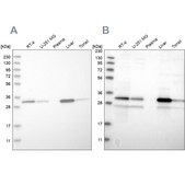 Anti-DECR1 antibody produced in rabbit Prestige Antibodies&#174; Powered by Atlas Antibodies, affinity isolated antibody, buffered aqueous glycerol solution, Ab3